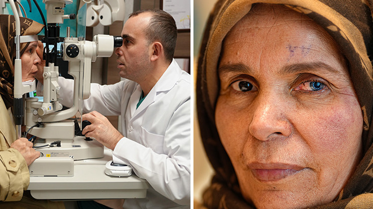 Geçirdiği operasyon sonrası iki farklı göz rengine sahip oldu Geçirdiği operasyon sonrası iki farklı göz rengine sahip oldu
