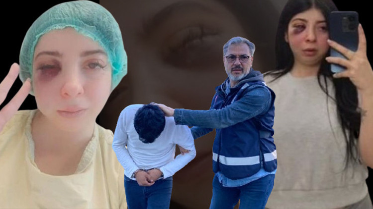 Samsunda yolda yürürken sözlü tacize uğradı, darbedildi Yaşadığı dehşeti anlatan Damla Korkmaz: Artık yüzümün sol tarafını hissetmiyorum Samsunda yolda yürürken sözlü tacize uğradı, darbedildi Yaşadığı dehşeti anlatan Damla Korkmaz: Artık yüzümün sol tarafını hissetmiyorum