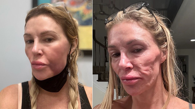 Ünlü oyuncunun büyük çaresizliği… Doktorlar sebebini bulamıyor… ‘Yüzüm eriyip gitti, perişanım’ Ünlü oyuncunun büyük çaresizliği… Doktorlar sebebini bulamıyor… ‘Yüzüm eriyip gitti, perişanım’