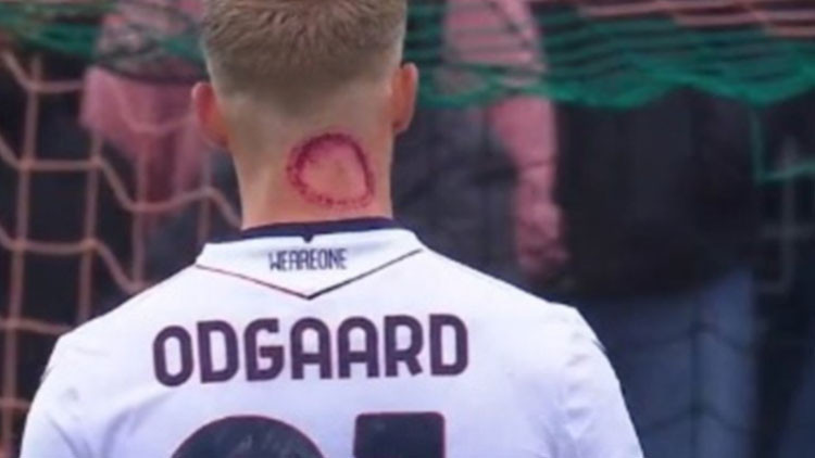 Korkutan görüntü Serie A oyuncusunun dikkat çeken görüntüsü