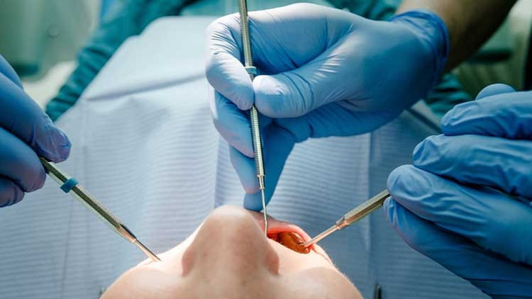 Amalgam diş dolgusu ağızdan çıkarılmalı mıdır Amalgam diş dolgusu ağızdan çıkarılmalı mıdır
