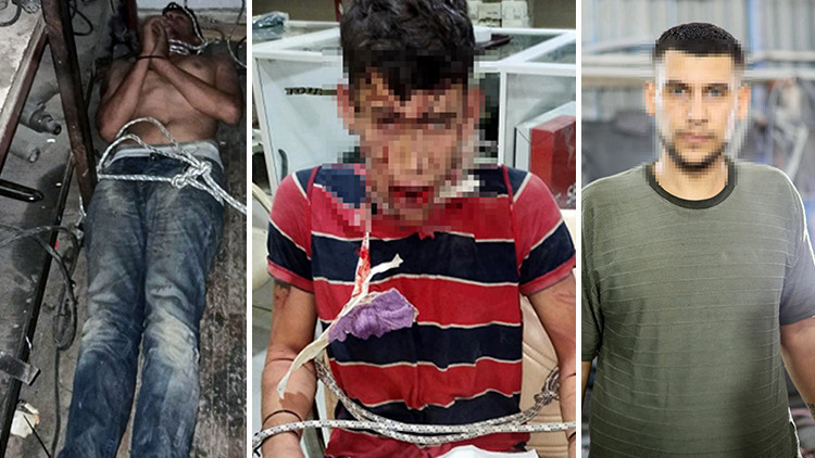 3 gün işkence gördü, Adli Tıptan gelen raporla şoke oldu