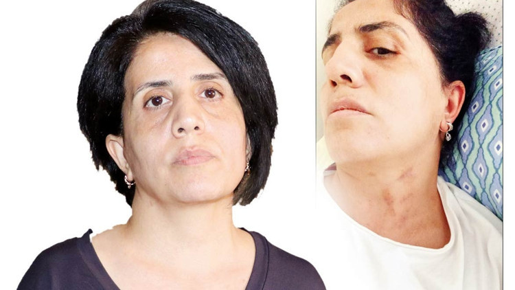 Sabiha’nın şiddet kabusu... Çocuğu olmuyor diye darp edildi