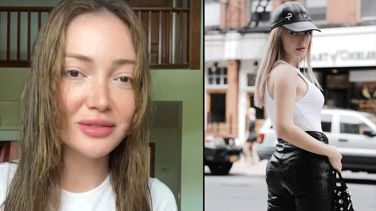 Kalça dolgusu kaburgasına çıktı... Danla Biliç doktorunu suçladı