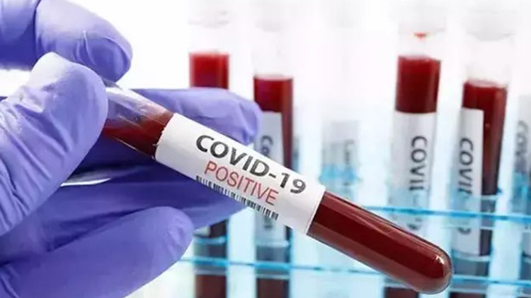 ABDde COVID-19 ölümleri arttı: Her hafta 300 kişi hayatını kaybediyor