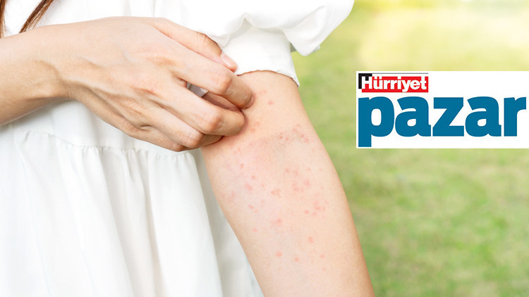 Beni hanginiz ısırdı