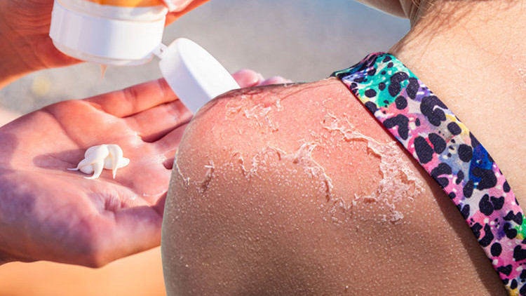 Güneş koruyucular gerçekten yaz kış kullanılmalı mı Cilt sorunlarına neden olur mu Her güneş koruyucu ‘korur’ mu 7 SORU 7 YANIT