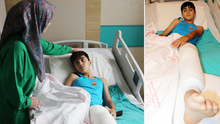 Şaka yaparken arkadaşını yaktı Şaka yaparken arkadaşını yaktı