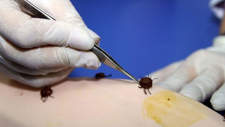 Dünyanın dört bir yanında görülüyor... Lyme hastalığı ‘ABD’nin biyolojik silahı mı