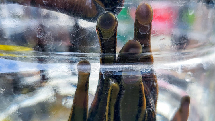 2500 yıllık gelenek can alıyor Enfeksiyon tüm vücudunu sardı, 7 ameliyatla hayata döndü Uzmanlardan kritik 10 uyarı