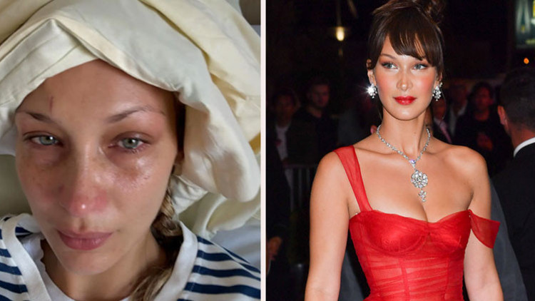 Güzelliği ve milyonları olsa neye yarar... Sağlığı çoktan gitti... Bir hastane odasında çaresiz hastalığıyla baş başa