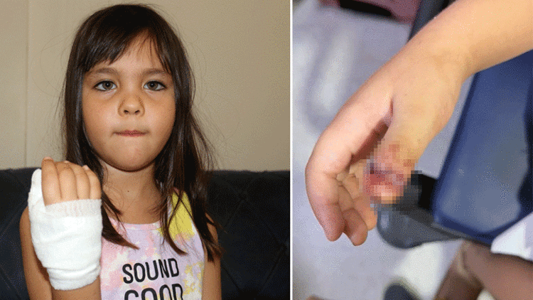 Antalyada anaokulunda korkunç olay 4 yaşındaki çocuğun parmağı, demir kapıya sıkışarak koptu