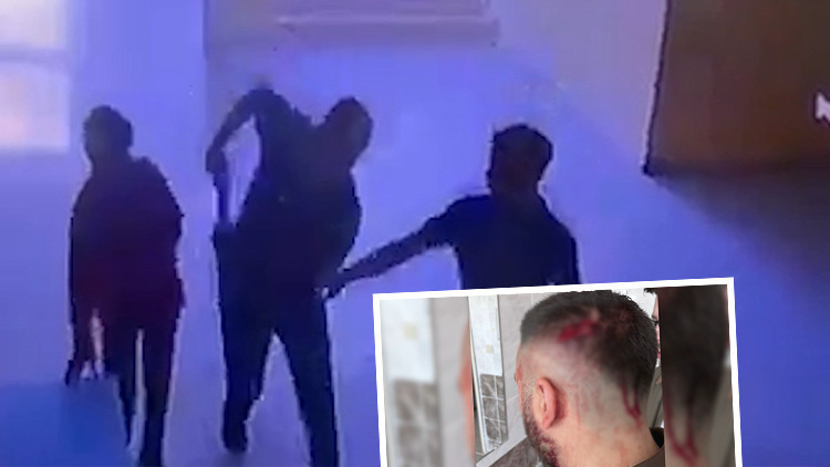 Demir sopalı saldırıya uğrayan öğretmen okuldaki görevinden ayrıldı