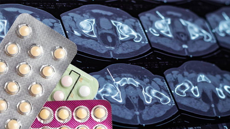 İki milyondan fazla kadın incelendi, sonuçlar oldukça endişe verici Doğum kontrol hapları o korkunç hastalığa neden oluyor olabilir