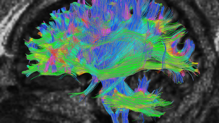 Bu araştırma yaşla ilgili bildiğimiz her şeyi yerle bir etti 32 yaşında ergenlikten çıkıyor, 66’da ise yaşlanmaya başlıyormuşuz