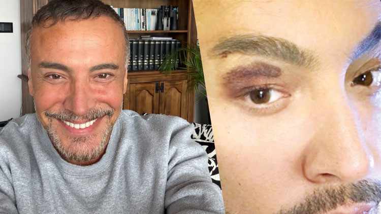 Cenk Eren sahne kazası geçirdi Cenk Eren sahne kazası geçirdi