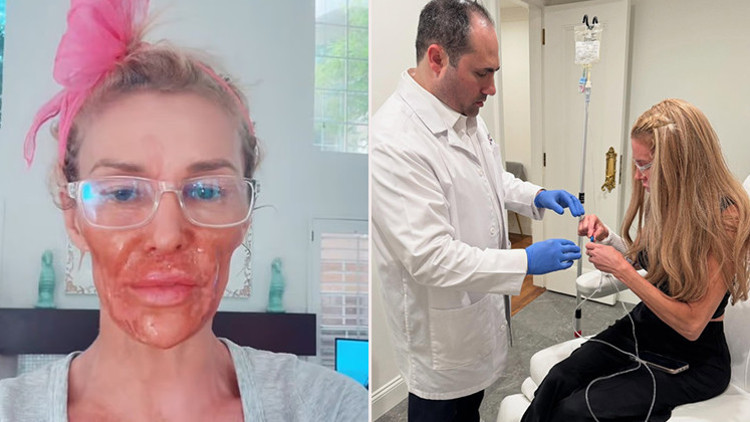 Ünlü yıldızın yüzü erimeye başlamıştı... Binlerce dolar harcadı, gerçeği buldu: Sonunda teşhis konuldu