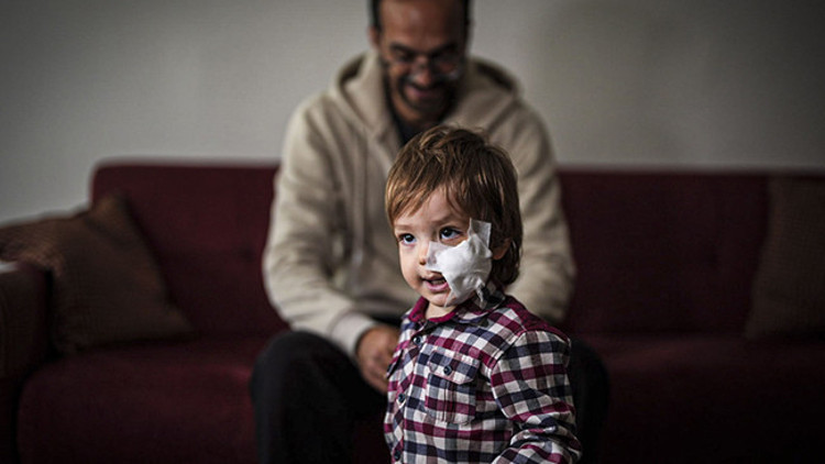 Ankarada iki kardeş pitbull saldırısına uğramıştı 1.5 yaşındaki Efe de taburcu oldu