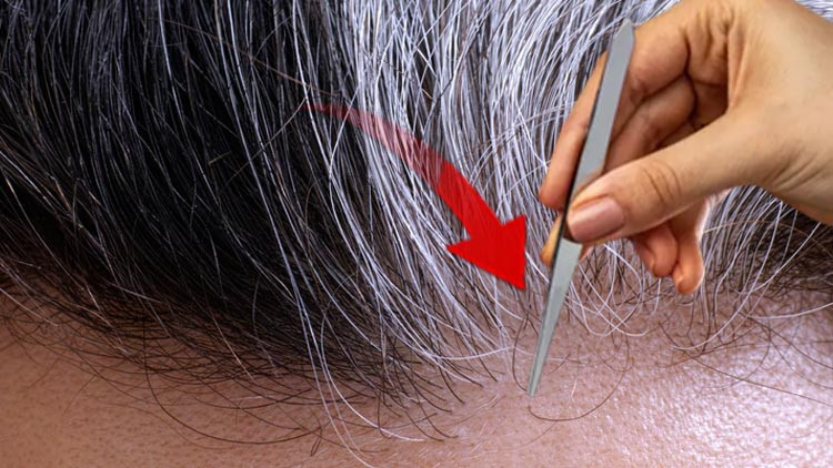 Saç beyazlamasını yavaşlatmak hatta tersine çevirmek mümkün mü Uzmanlar uyarıyor Cımbızdan uzak durun Saç beyazlamasını yavaşlatmak hatta tersine çevirmek mümkün mü Uzmanlar uyarıyor Cımbızdan uzak durun