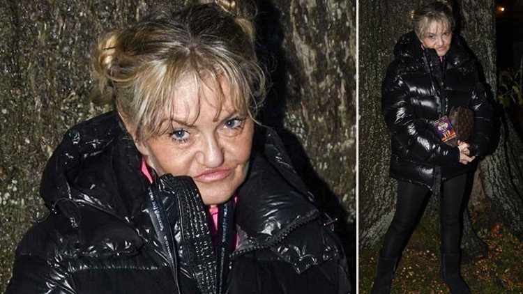 Erken gelen şöhret hayatını kararttı... Dağılan yüzünü toplamak için servet harcıyor: Aynaya bakamaz oldum