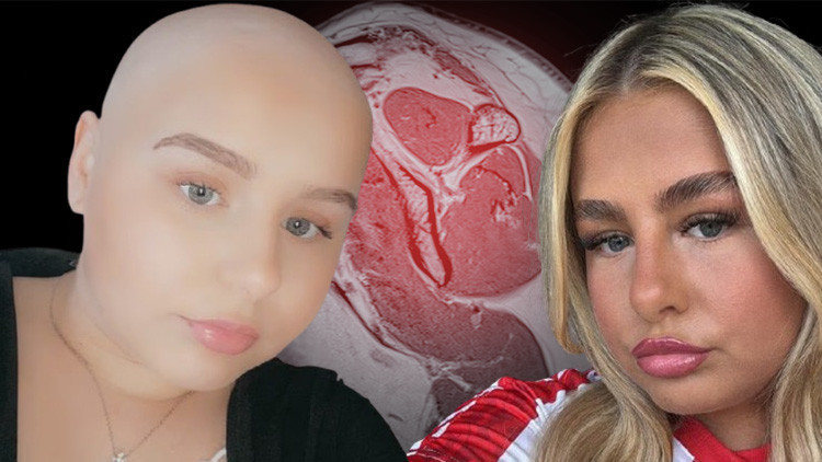 Omzundaki ağrı için doktor aylarca kas zorlanması dedi, korkunç gerçek bir yılbaşı günü fark edildi: Kulaklarıma inanamadım, daha 16 yaşındaydım