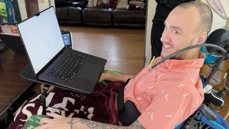 Beyin çipine 21 gönüllü