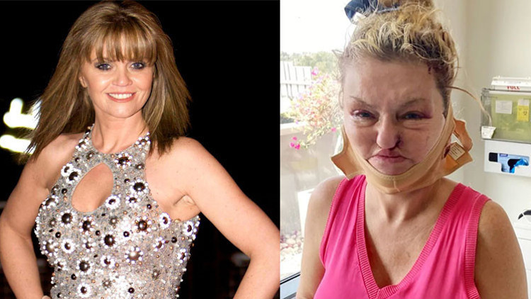 O bebeksi görüntüsü hatıralarda kaldı... Güzelleşme hırsı ünlü oyuncunun yüzünü de parasını da aldı götürdü