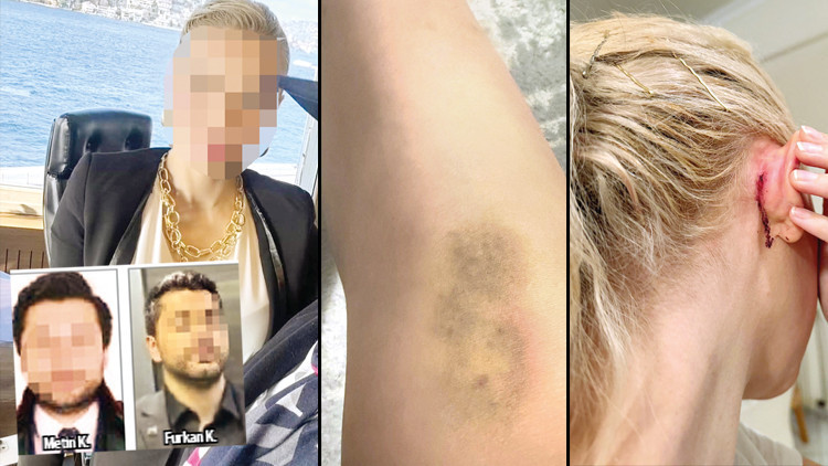 Ünlülerin avukatına saldırdılar Ünlülerin avukatına saldırdılar