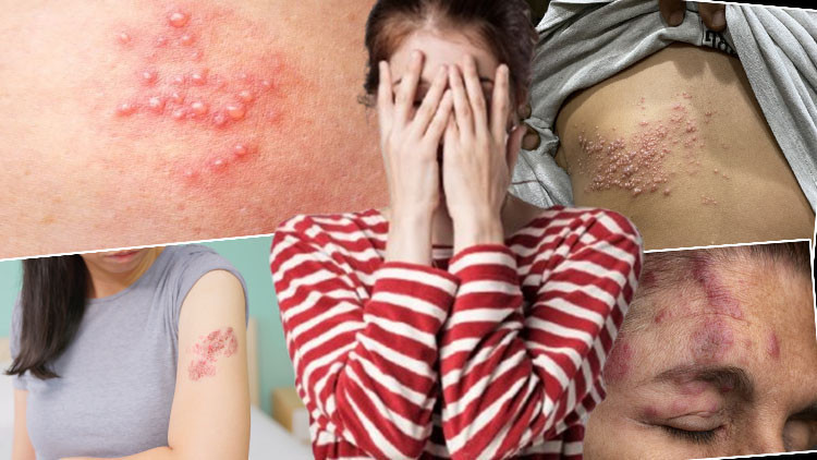 Gençleri hedef alıyor: Ölümcül olabiliyor ‘Derime kaynar su dökülmüş gibiydi’, ‘Eve kapandım, dışarı çıkamadım’