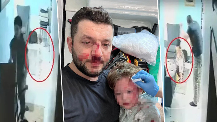 14 aylık İkra ile babasının darbedilmesine ilişkin iddianame hazırlandı Çocuk skuterı silah olarak sayıldı... İşte istenen ceza