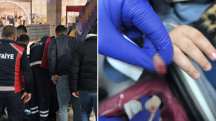 AVMde korkunç olay Yürüyen merdivene eli sıkışan 3 yaşındaki çocuğun parmağı koptu AVMde korkunç olay Yürüyen merdivene eli sıkışan 3 yaşındaki çocuğun parmağı koptu