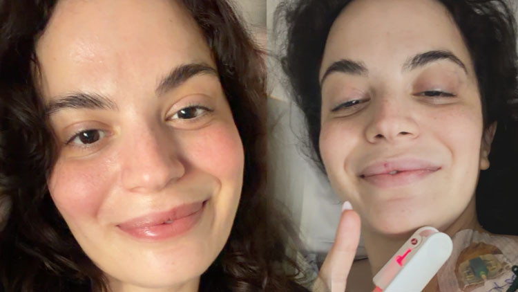 Aslı Bekiroğlu 7. kez ameliyat oldu Aslı Bekiroğlu 7. kez ameliyat oldu