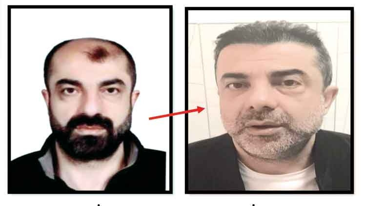 Azmettirici ameliyatla yüzünü değiştirmiş