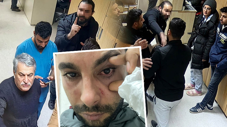 Doktordan hastaya yumruklu saldırı iddiası: Yüzde 30 görme kaybı oluştu | Düşmanına vurur gibi yumruk atıyor