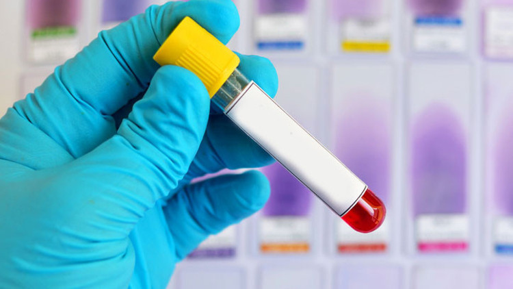 Alzheimer riskini öngören yeni bir kan testi yolda! Tam olarak ne zaman hazır olacak?