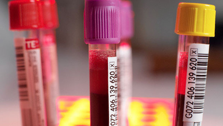 Demir nedir Demir minerali ne işe yarar