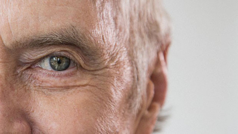 Mimik egzersizleri ile kırışıklıkları önleyin