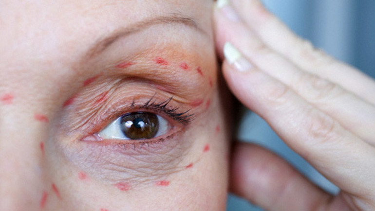 Estetik kraliçesi Wildensteinın hayat hikayesi