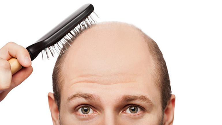 Türkiye saç ekiminde neden lider