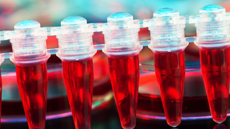 Hemofili için gen tedavisi umudu