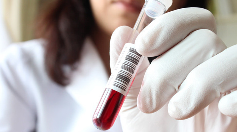 Atilla Özdemiroğluna uygulanan o tedavi nedir