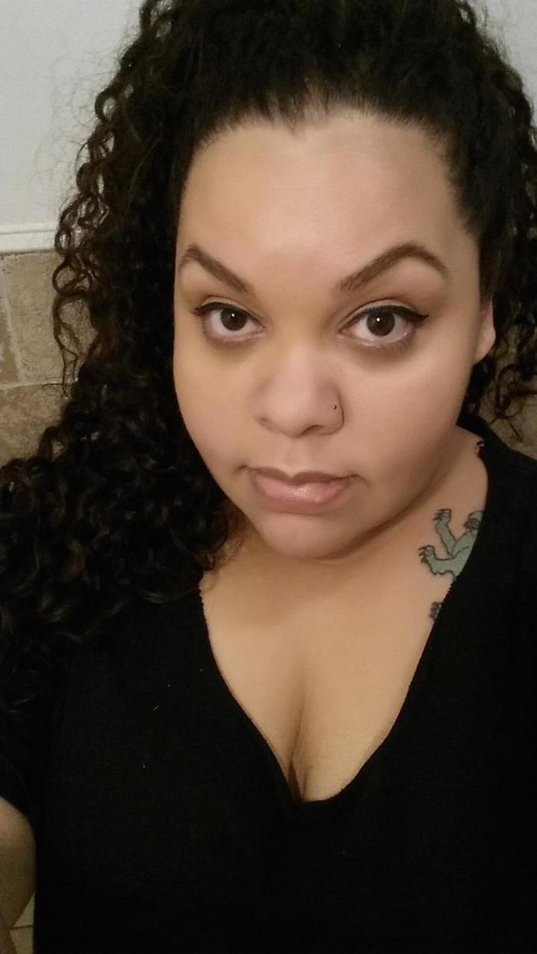 Simli göz farı genç kadını gözünden etti