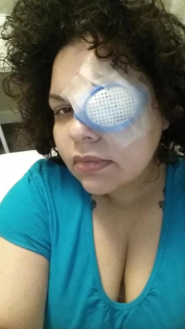 Simli göz farı genç kadını gözünden etti