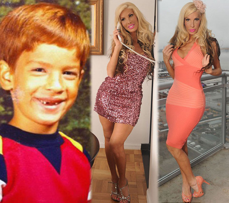 Barbie bebeğe benzemek için servet harcadılar