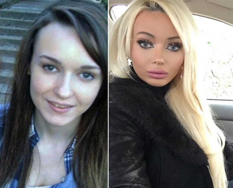 Barbie bebeğe benzemek için servet harcadılar