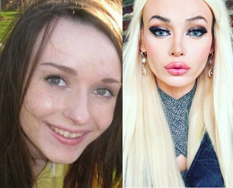 Barbie bebeğe benzemek için servet harcadılar