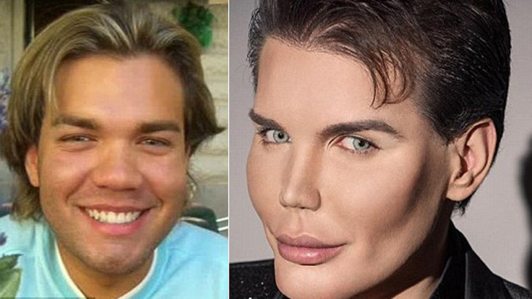 Barbie bebeğe benzemek için servet harcadılar