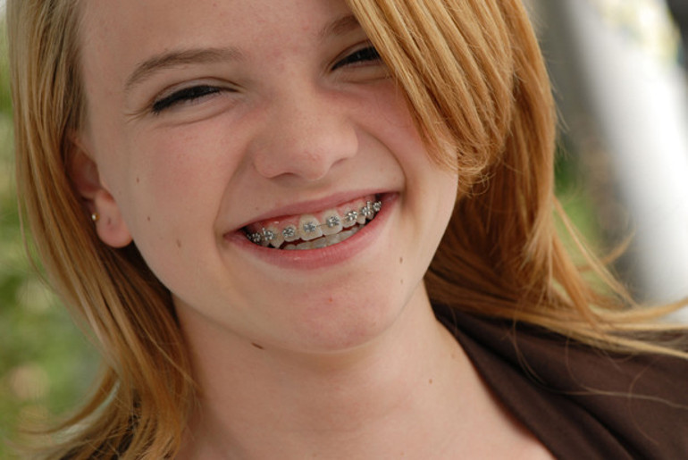 Ortodontik tedavide zamanlama