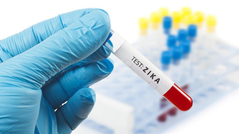 Zika virüsü spermde 6 ay yaşayabiliyor