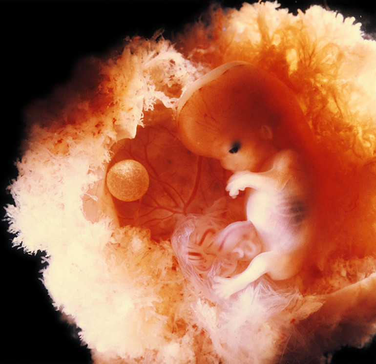 Fetus fotoğraflarıyla tanınan ünlü sanatçı hayatını kaybetti